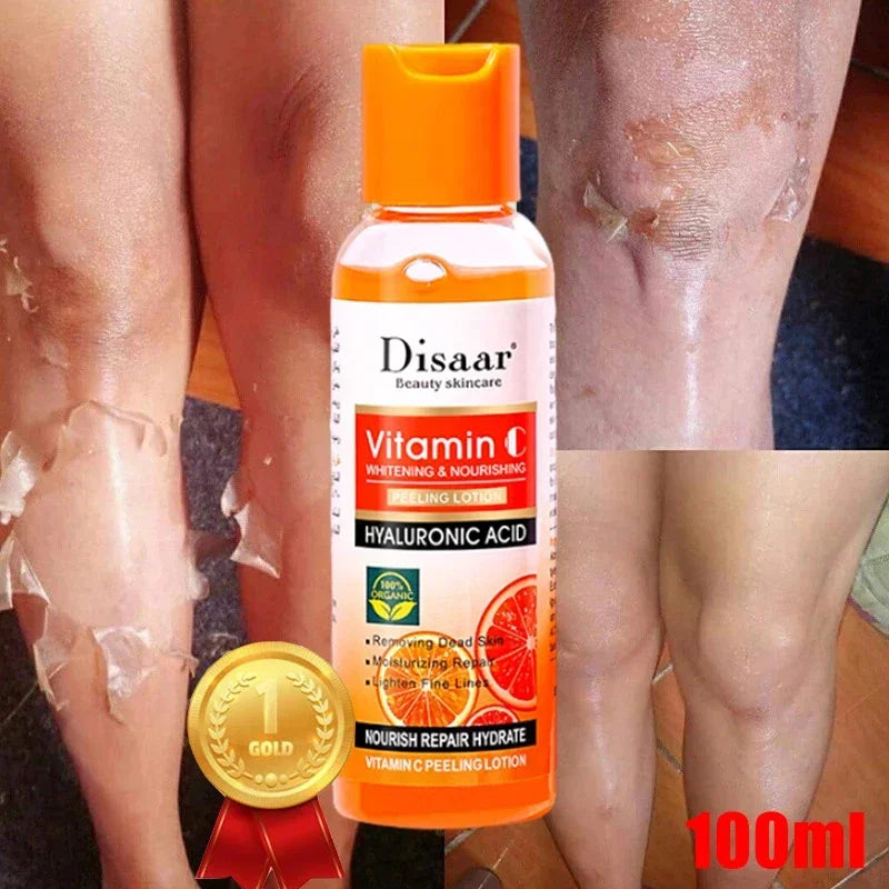 Yellow Peeling Lotion Orgánica – Exfoliante Aclarante para Manchas Oscuras con Ácido Hialurónico