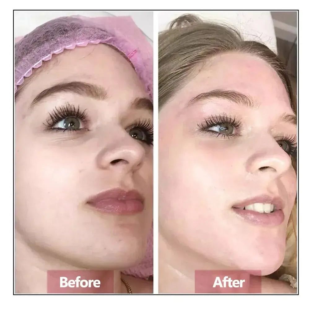Sérum Facial con Ácido Hialurónico – Hidratación, Reparación y Efecto Rejuvenecedor