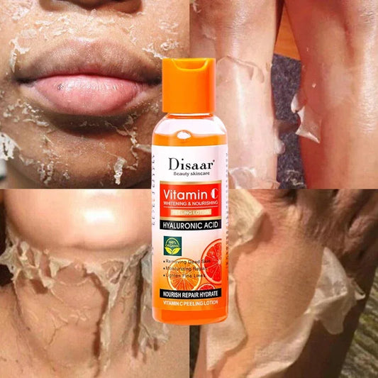 Yellow Peeling Lotion Orgánica – Exfoliante Aclarante para Manchas Oscuras con Ácido Hialurónico